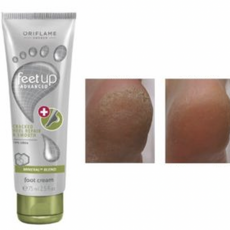 33027 KEM DƯỠNG DA CHÂN - Feet Up Advanced  