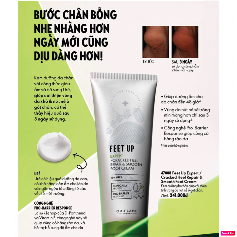 47008 Kem dưỡng da chân Feet Up Expert Cracked Heel Repair & Smooth Foot Cream